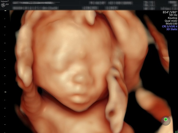 Hình ảnh siêu âm thai nhi 21 tuần tuổi